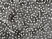 English: Hepatitis B virus surface antigen. Transmission electron Micrograph