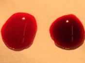 English: Two drops of blood are shown with a bright red oxygenated drop on the left and a deoxygenated blood on the right.