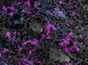Immune Cells Surrounding Hair Follicles in Mouse Skin