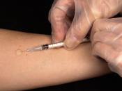 The Mantoux skin test consists of an intradermal injection of exactly one tenth of a milliliter (mL) of PPD tuberculin.