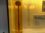 English: The central nervous system of the human (the brain and the spinal cord) at the Natural History Museum in London. Magyar: Az ember központi idegrendszere (az agy és a gerincvelő) a londoni Természettudományi Múzeumban.