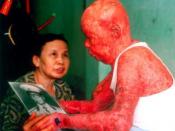 Major Tự Đức Phang was exposed to dioxin-contaminated Agent Orange