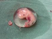 English: A six week embryonic age or eight week gestational age intact Embryo, found in a Ruptured Ectopic pregnancy case.