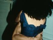 Nan Goldin, The Hug, NYC, 1980, cibachrome, 40 x 30 inches