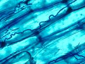 English: Blue-stained serpentine Neotyphodium coenophialum mycelia inhabiting the intercellular spaces of tall fescue leaf sheath tissue. Magnified 400x. Français : Neotyphodium coenophialum