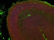 Embryonic mouse cortex with a cool neuron (20X)