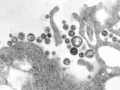 A transmission electron micrograph (TEM) of a number of Lassa virus virions adjacent to some cell debris. The virus, a member of the virus family Arenaviridae, causes Lassa fever. Source:CDC's Public Health Image Library Image #8700 Photo Credit: C. S. Go
