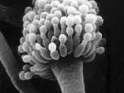 Aspergillus fumigatus as seen under the electron microscope