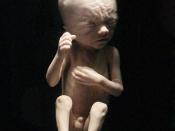 fetus development - 23 weeks
