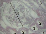 histology of the cortex of a kidney; 1—Glomerulus, 2—Wikipedia:Proximal convoluted tubule, 3—Wikipedia:Distal convoluted tubule