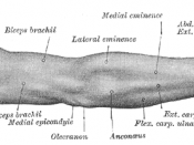 Back of right upper extremity.