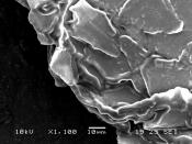 English: Zoomed version of human dandruff by a scanning electron microscope