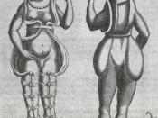 English: Engraving representing contemporary ideas on hermaphroditism, circa 1690.