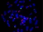 English: Metaphase spread of HCT116 cells stained for γ‐H2AX (green) and telomeric DNA (red) Deutsch: Humane Chromosomen von HCT-116-Kolonkarzinom-Zellen, bei denen γ‐H2AX grün-fluoreszierend und die Telomere rot-fluoreszierent angefärbt wurden.