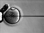 Intracytoplasmic sperm injection can be used to provide fertility for men with cystic fibrosis