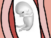 This is am image of a fetus about to be vacuumed out of the uterus in an abortion.