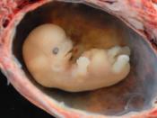 Approximately 6 weeks from conception, i.e. 8 weeks from LMP. Shot with 105 mm Micro-NIKKOR lens with 2 off camera SB-800's. Specimen is submerged in alcohol. This is a spontaneous (ie. not a termination) abortion. It was extruded intact with the gestatio