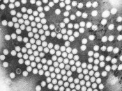English: Electron micrograph of the poliovirus. Poliovirus is a species of Enterovirus, which is a Genus in the family of Picornaviridae, and is an RNA virus. Deutsch: Polioviren im Transmissionselektronenmikroskop. Français : Le virus de la polio. 日本語: ポ