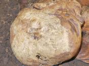English: Photo of the top of the Lindow man's head. The V shaped cut can be seen on the lower centre.