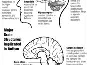 Major brain structures implicated in autism.