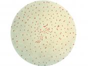 Gram stain of the bacteria Bordetella pertussis.