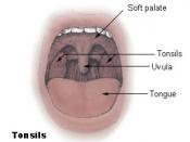 Diagram of the palatine tonsils from U.S. National Cancer Institute web site http://training.seer.cancer.gov/module_anatomy/unit8_2_lymph_compo2_tonsils.html, Uploaded on 18 December 2004 from U.S. National Cancer Institute training web site