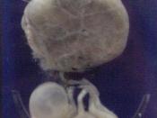 English: 3 month old fetus attached to umbilical cord