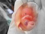 fetus 10weeks