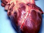 English: Human heart. Picture taken during autopsy.