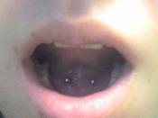 Tongue frenulum piercing