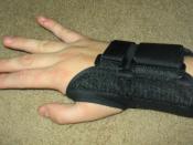 A rigid splint can keep the wrist straight.