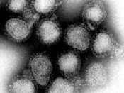 The influenza viruses that caused the Hong Kong flu. (magnified approximately 100,000 times)