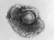 Electron micrograph of a Varicella (Chickenpox) Virus. Varicella or Chickenpox, is an infectious disease caused by the varicella-zoster virus, which results in a blister-like rash, itching, tiredness and fever.