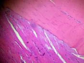 Fibras musculares estriadas esqueléticas e fibras colágenas do tendão