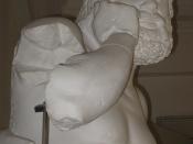 Aeschylus put-in-plaster thinking with an arm-crutch {because the sculpture fell apart during WWII}