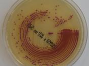 Escherichia coli on ChromID CPS agar
