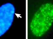 Left: DAPI stained female human fibroblast with Barr body (arrow). Right: histone macroH2A1 staining. Arrow points to sex chromatin in DAPI-stained cell nucleus, and to the corresponding sex chromatin site in the histone macroH2A1-staining.