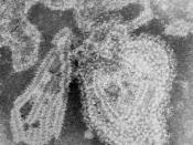English: This 1976 negative stained transmission electron micrograph (TEM) depicted the ultrastructural features displayed by the mumps virus. Deutsch: Aus dem Virion freigesetzte Anteile des helikalen Kapsids. Polski: Mikrofotografia wirusa świnki. Españ