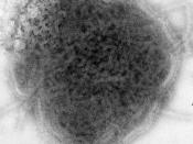 Mumps virus, negative stained TEM 8758 lores