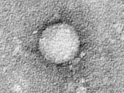 English: Hepatitis C virus purified from cell culture. Courtesy of the Center for the Study of Hepatitis C, The Rockefeller University.