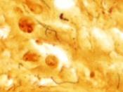 English: Micrograph showing Treponema pallidum the spirochete that causes syphilis. Dieterle stain. See also Image:Treponema pallidum - very high mag.jpg