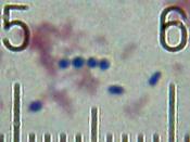 English: Some bacteria, presumably Streptococcus thermophilus from a sample of Activia ® brand yogurt. 100× objective, 15× eyepiece. Numbered ticks are 11 µM apart. The scale of the full-sized version of this image is such that each 