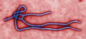 English: Ebola virus virion. Created by CDC microbiologist Cynthia Goldsmith, this colorized transmission electron micrograph (TEM) revealed some of the ultrastructural morphology displayed by an Ebola virus virion.
