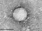 English: Electron micrographs of hepatitis C virus purified from cell culture. Scale bar is 50 nanometers. Courtesy of the Center for the Study of Hepatitis C, The Rockefeller University.