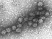 West Nile virus EM PHIL 2290 lores