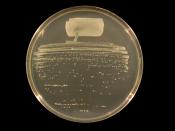 English: The bacterium Rhizobium tropici strain BR816 streaked to single colonies on Tryptone-Yeast Extract (TY) agar.