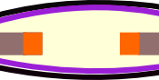 cartoon of synovium made by Cayte using Inskscape And GIMP Black is subintima, purple is intima,light brown is bone, orange is cartilage, yellow is synovial fluid
