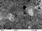 Transmission electron microscope image showing lateral membranes of two cells at the site of two desmosomes. The intermediate filaments, associated with the two desmosomes are visible in this image. JEOL 100CX TEM