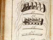 Early 18th century diagram made by doctor Fauchard on his book where he shows the procedure involved in teeth restoration.