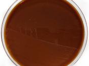 Neisseria gonorrhoeae on Chocolate Columbia Horse Blood Agar